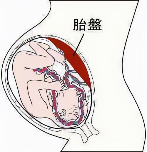 科普生完小孩胎盤怎麼處理呢