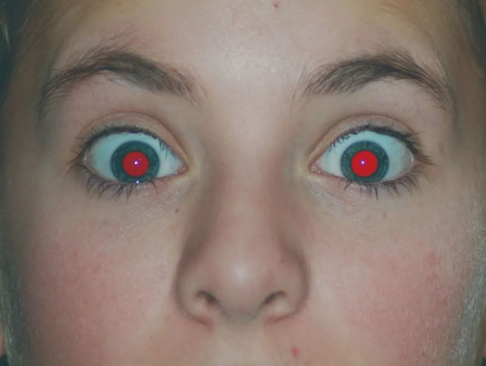 照片里红眼其实是眼睛里的脉络膜结缔组织,而红眼的出现环境经常是在