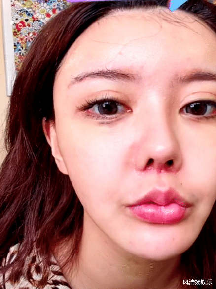 兜儿直播时卸妆,鼻子红肿像整容后留的疤痕,与韩安冉有一拼