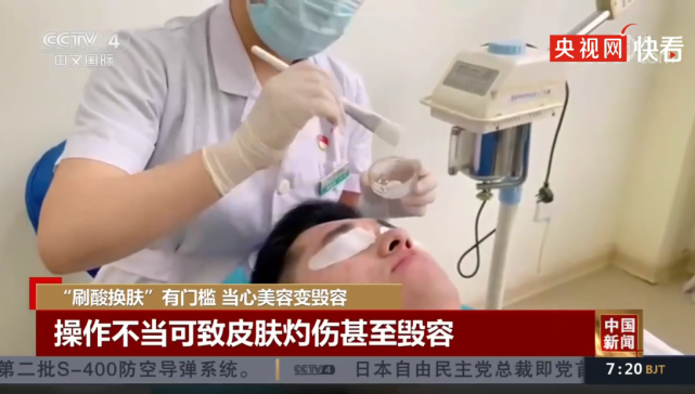 刷酸一定不要自行操作操作不当可毁容