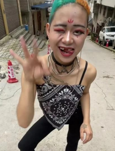 那个为了红打掉门牙的网红,终于被封号了