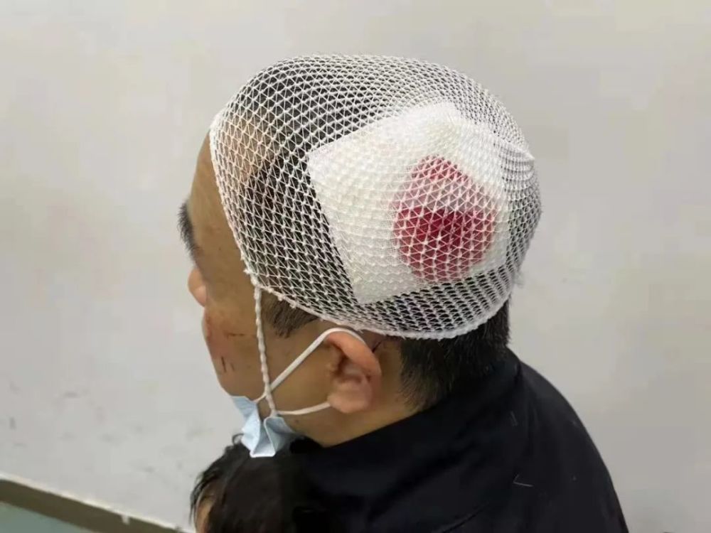 吉林市一男子骑电瓶车撞伤怀抱幼童的父女后在医院内溜了谁认识他