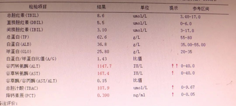 湖南女童肝功能严重衰竭竟是与家长喂服土方子有关