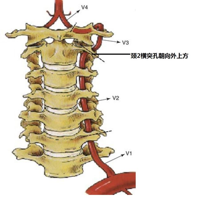 基础必学:椎动脉走形图谱