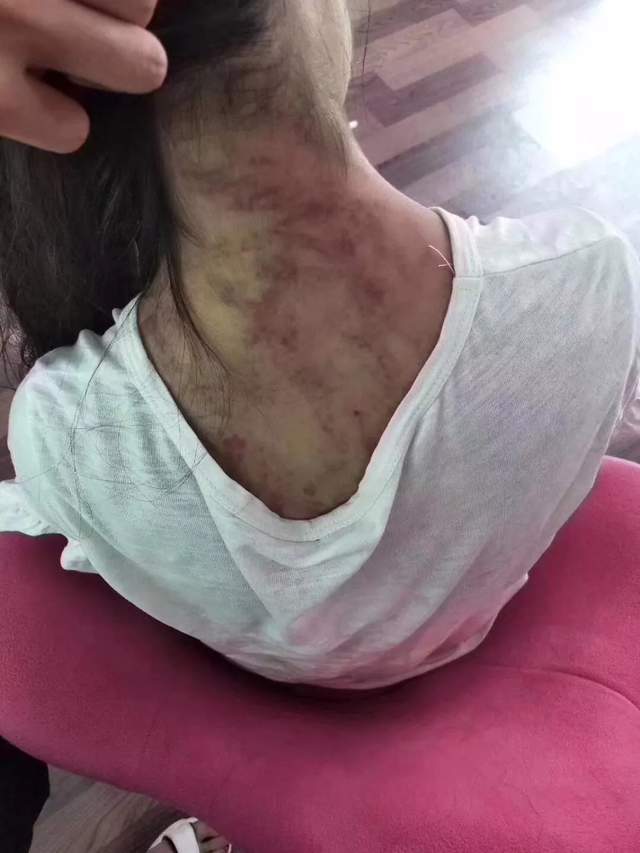 青海母亲燕志云虐女,滚油灌嘴纱线封口,被判7年,出狱挖坟泄愤_腾讯