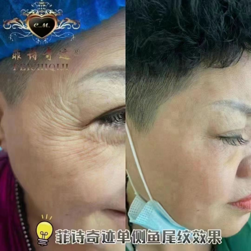 菲诗奇迹公司负责人怎么联系?