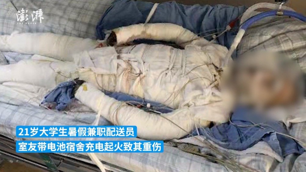 21岁大学生因室友不听劝阻带电动车电池回宿舍充电引发火灾,造成烧伤