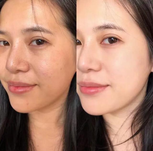 皮肤暗沉泛黄真的太显老!5个方法:和暗沉,黄气说拜拜_腾讯新闻