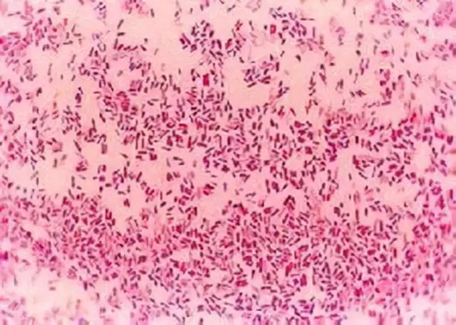 大肠杆菌是敌是友