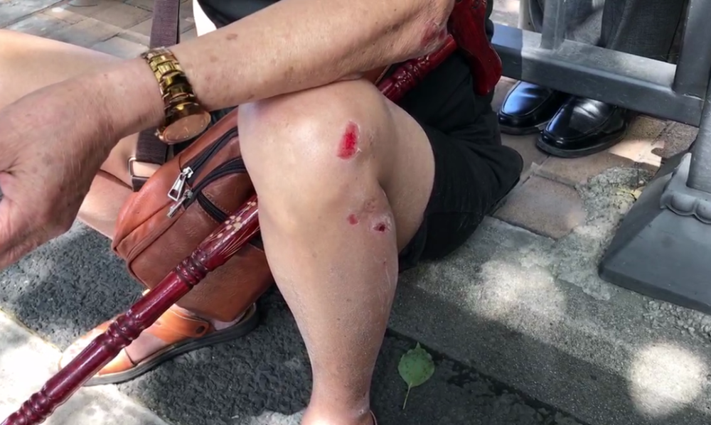 突发贵阳这里发生交通事故一位老人疑似过马路被撞伤