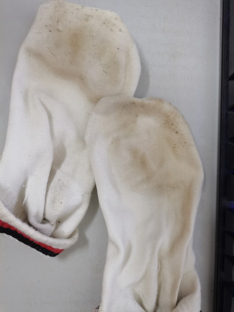 白衣服和白袜子发黄怎么办?