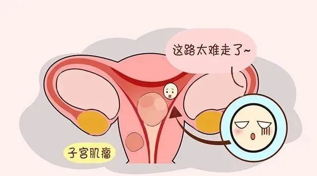 南昌华儿山生殖医院科普:子宫肌瘤对女性怀孕有影响吗?