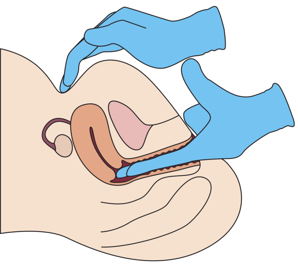 第一次看妇科竟然花了7000块这份妇科避坑指南快收好