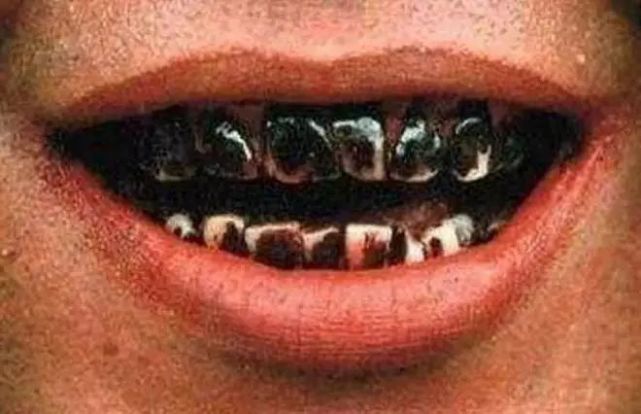 吃槟榔牙齿会变黑吗图片