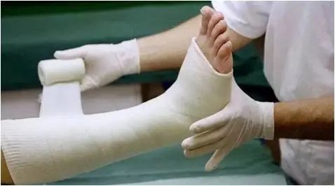 肌腱断裂后为什么要用石膏固定呢?