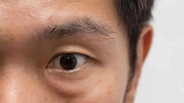 男性老不老,早上起床就知道?别羞于查看