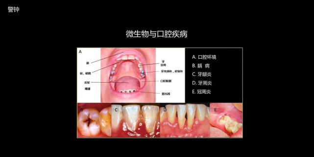 【图文实录】陈峰:无视口腔菌群,不谈肠道和全身健康!