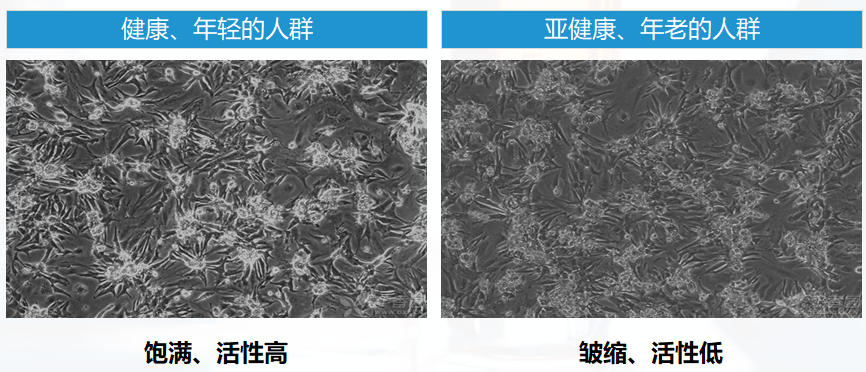 抗衰老是治標還是治本從技術源頭上聊聊nmn細胞療法nad