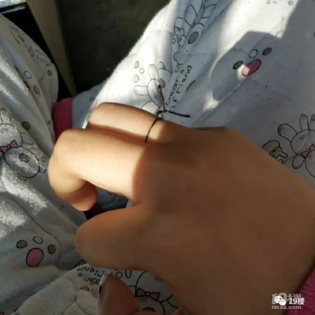 姑娘眼里长了它,被迫戴墨镜上班,还被亲妈质疑|针眼|麦粒肿|眼药水