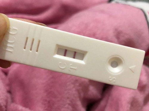 检验医师使用人绒毛膜促性腺激素(hcg)试纸条(即俗称的验孕棒)对血液