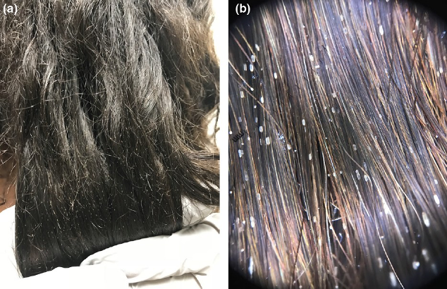 这种串在孩子头发上的"颗粒"不简单