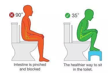排便姿势也会引发痔疮?老中医表示:对症下药远离痔疮,健康你我他!