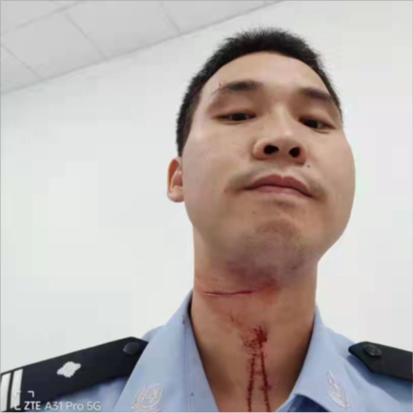 民警摔倒后起身狂追,抓到网逃后才发现脖子受伤