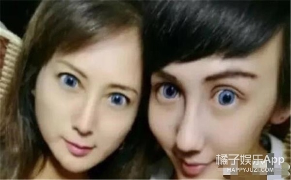 还记得整容界网红刘梓晨吗？相比之前也帅太多了吧？_腾讯新闻