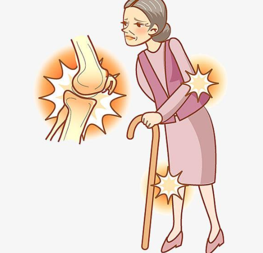 气温骤降骨关节炎患者如何保养关节专家告诉你