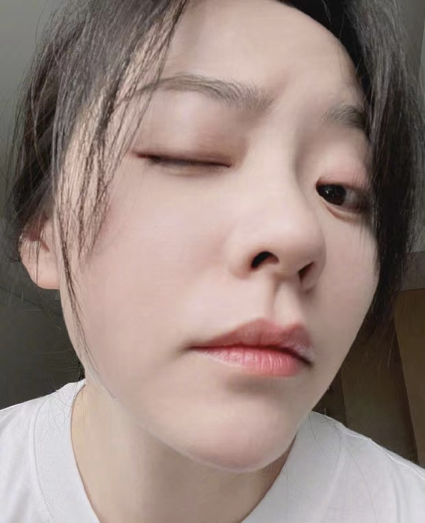 张靓颖晒怼脸自拍照,庆祝自己37岁生日,素颜出镜皮肤状态极佳