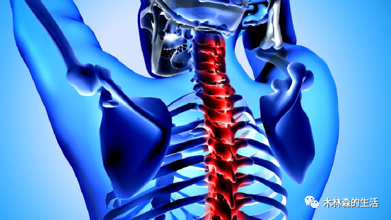 骨科专家:治疗颈椎病的方法,并教你四个预防小妙招!