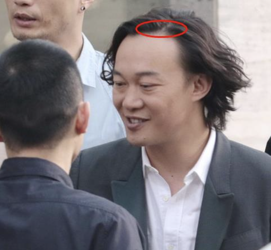 中年男星秃头灾情惨重头顶稀疏能反光后脑勺都没几根毛