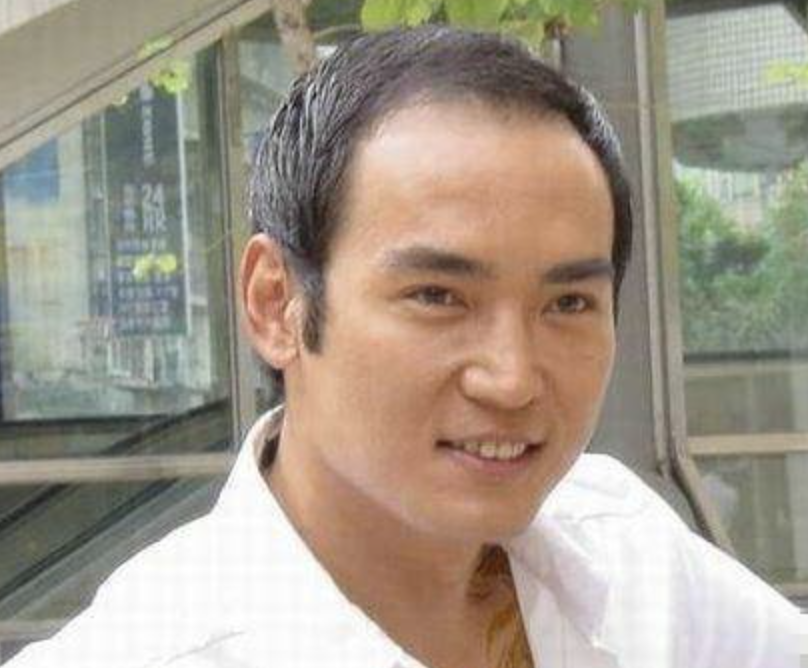 中年男星秃头"灾情"惨重!头顶稀疏能反光,后脑勺都没几根毛