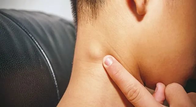 孩子耳后,颈部长这种鼓包是什么问题?需要担心吗?_腾讯新闻