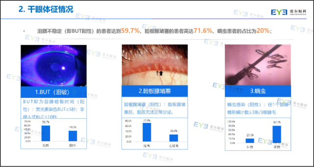 爱尔重磅发布：5大生活习惯可致干眼，30岁以上人群更易“中招”(图2)