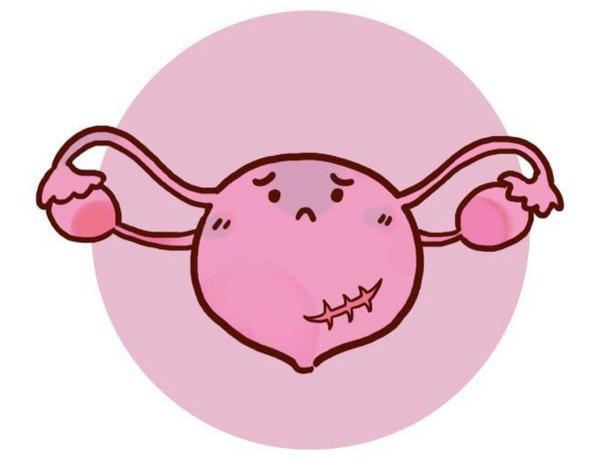 贝安健康子宫破裂有什么征兆