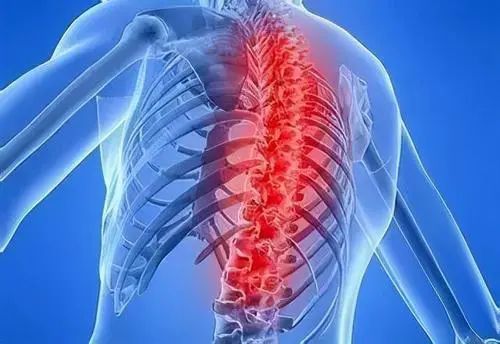 终板和椎体骨质都可能发炎那是不是脊柱发炎就一定是强直性脊柱炎呢?