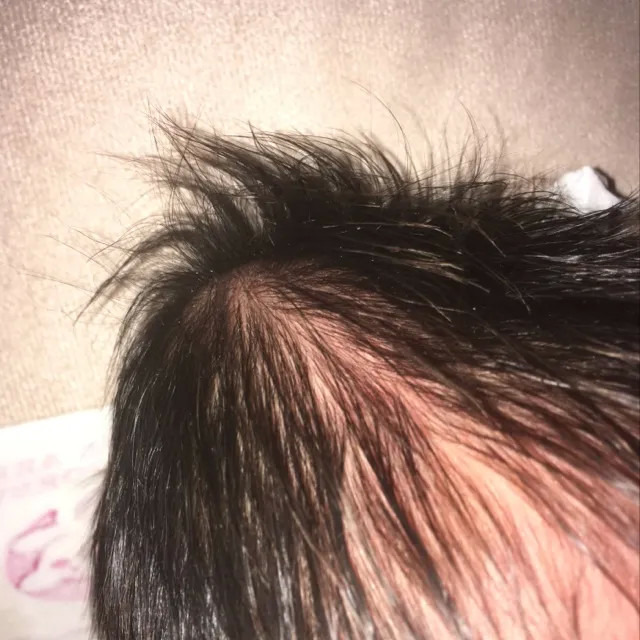 想象中的宝宝都是头圆圆的,看起来可爱极了,可是有些新生儿头却是尖尖