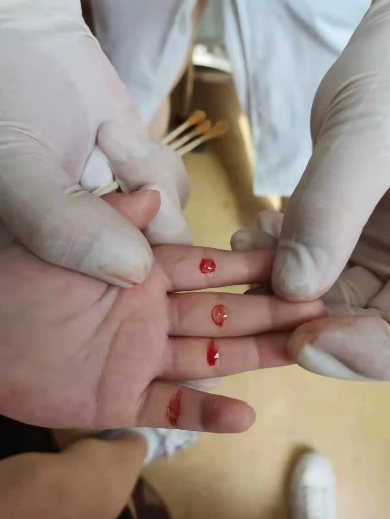 挑四缝小儿捏痧小儿针灸小儿拔罐还有中药内服,穴位贴敷,小针刀