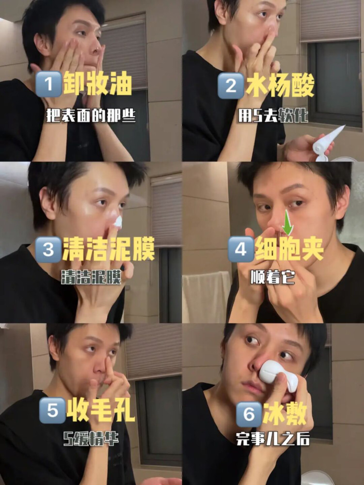 骆王宇保姆级去黑头教程