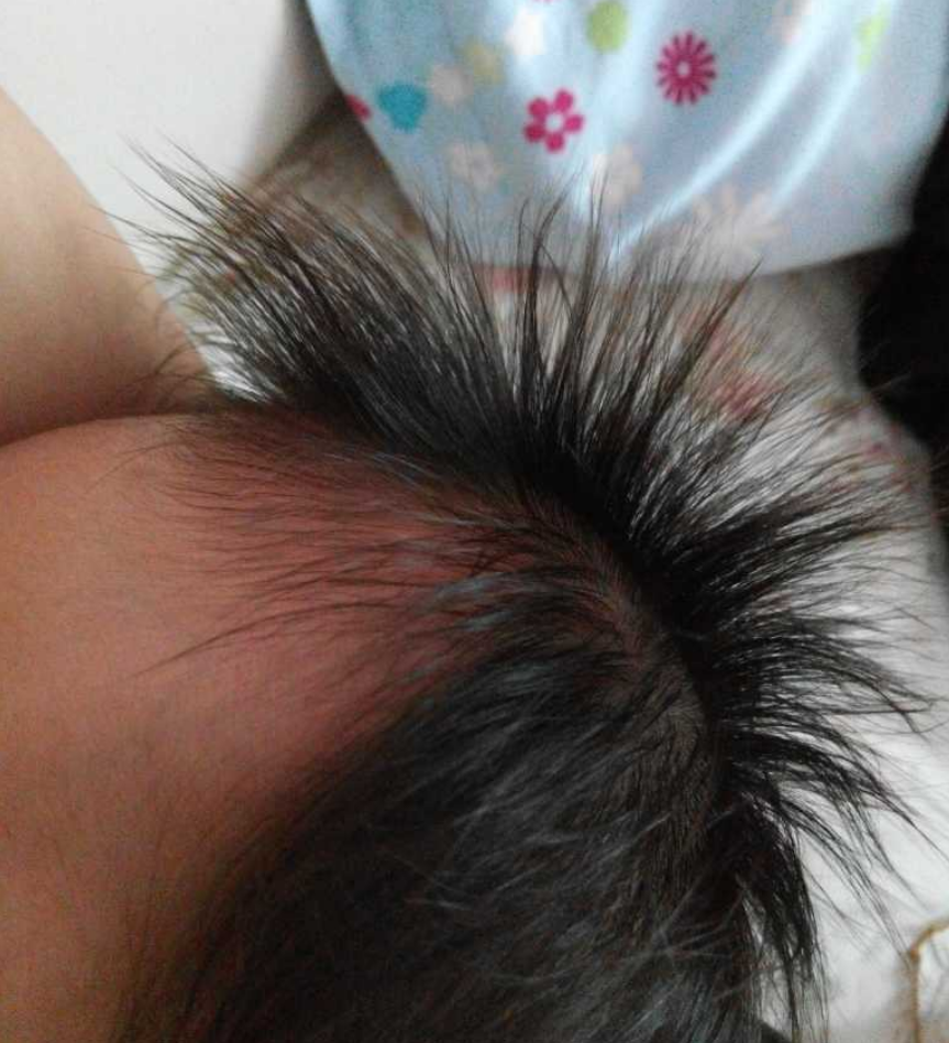 宝宝健不健康其实头发就是风向标若有这些特征可能遭罪