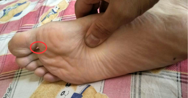 降压的特效穴