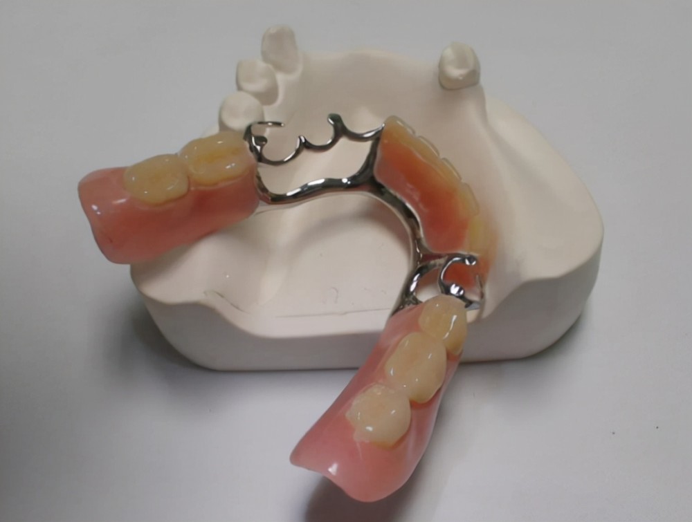活动假牙在戴入口腔后,会遭到唾液,食物残渣,烟,茶,微生物等各种物质