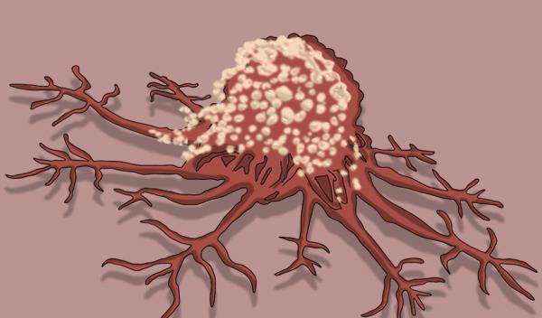 癌细胞扩散,还有得救吗?