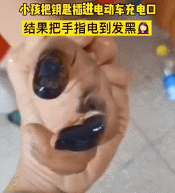 小孩如此操作,手被烧黑!|电动自行车|武汉|广东湛江