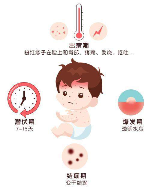 大人小孩都易中招的水痘!这些战痘宝典拿走不谢!