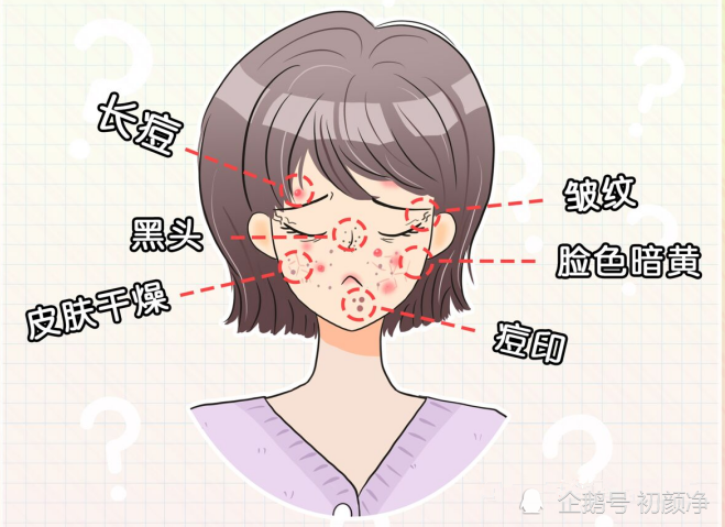 长久以来皮肤没有得到保护容易衰老导致皮肤变差3