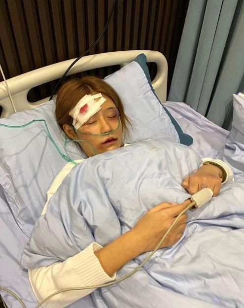 百万粉丝网红王多鱼被男友打伤住院远离家暴男保平安