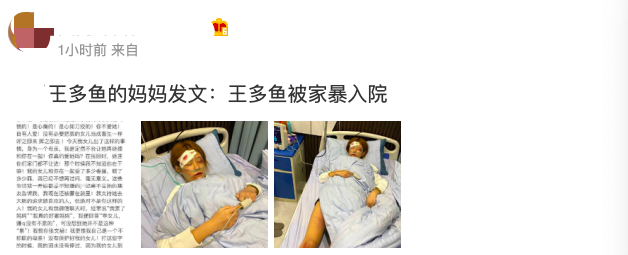百万粉美女网红遭男友家暴入院,面部青紫满身伤,妈妈发文控诉