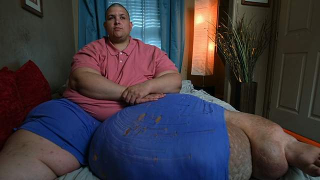 小哥体重800斤,宅家八年大吃大喝,胖到危及生命却管不住嘴